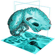 BigBrain