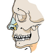 Maxilloclic